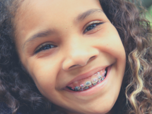 A close-up of a child with braces smiling, Experience FastBraces® In Orem, UT at Orem Pediatric
