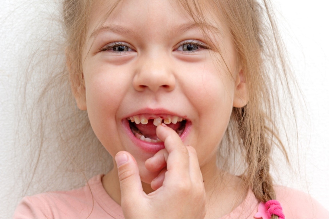 A picture containing child, loose tooth, Pulling Your Child’s Loose tooth