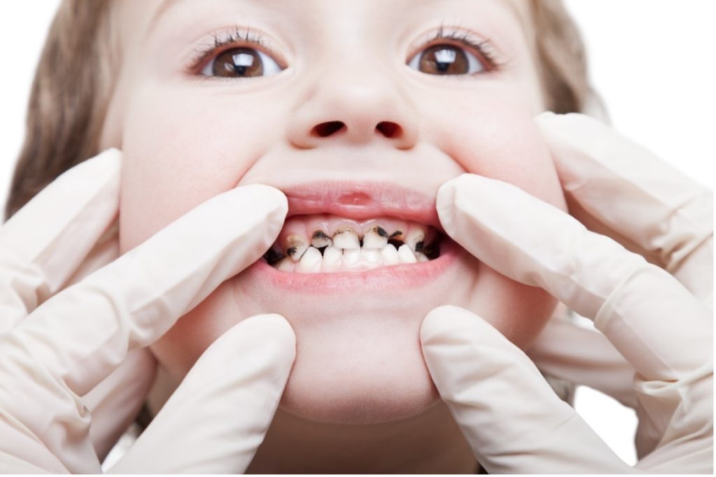 A picture containing child, dentist inspecting teeth, cavities