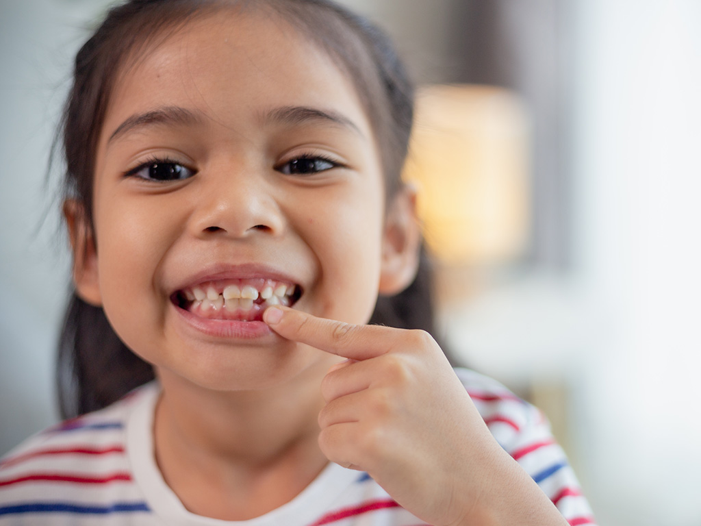 FastBraces®: Get Straighter Teeth in Just 100 Days at Orem Pediatric